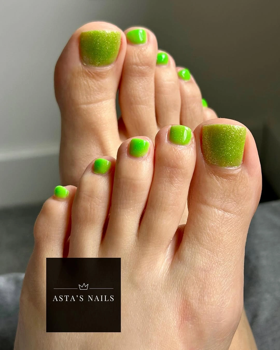 august pedicure nails ideas 2026 Fresh Lime Duo with a Soft Shimmer Twist